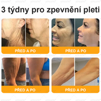 🎁 Posledních 5 kusů! Přidejte do košíku a získejte 70% slevu!